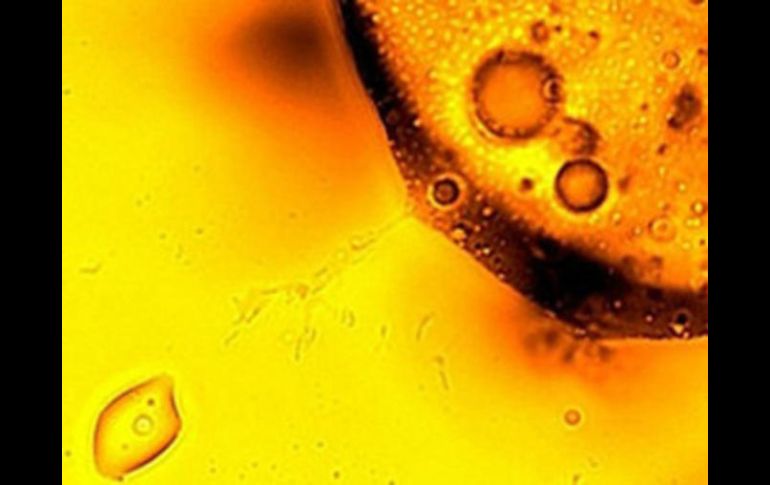 Los probióticos necesarios que ayuden a combatir a los microorganismos que dañan la salud humana. EFE / ARCHIVO