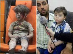 Hace 10 meses unas imágenes del pequeño Omran dieron la vuelta al mundo y se convirtieron en símbolo de la crudeza de la guerra. ESPECIAL /