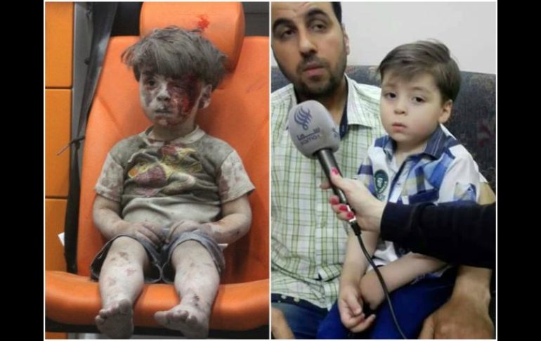 Hace 10 meses unas imágenes del pequeño Omran dieron la vuelta al mundo y se convirtieron en símbolo de la crudeza de la guerra. ESPECIAL /