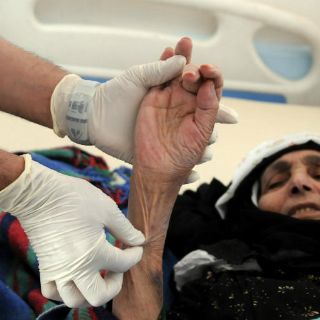 Registran 746 muertos por brote de cólera en Yemen