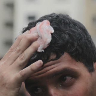 Golpes en la cabeza provocan pérdida de neuronas