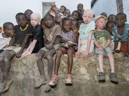 Al menos 20 personas con albinismo han muerto en Malaui desde noviembre de 2014, y 117 sufrieron ataques. ESPECIAL /