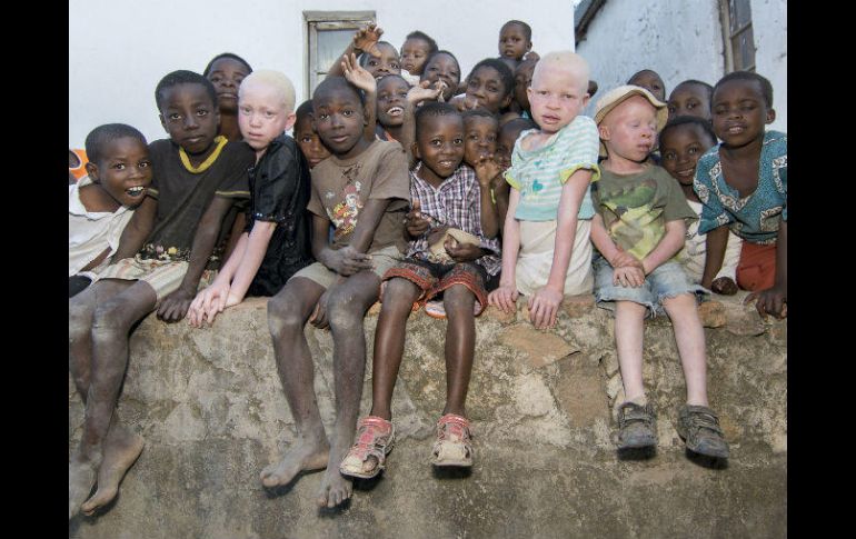 Al menos 20 personas con albinismo han muerto en Malaui desde noviembre de 2014, y 117 sufrieron ataques. ESPECIAL /