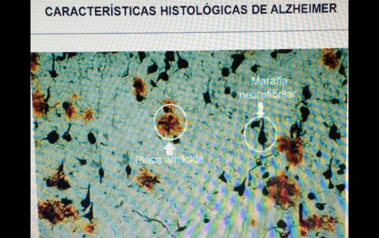 Los investigadores tienen el propósito de ampliar este estudio en un futuro mediante el análisis de un mayor número de muestras. NTX / ARCHIVO