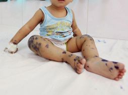 23 nuevos casos se concentran en municipios de la región Mixteca y los Valles Centrales. EFE / ARCHIVO