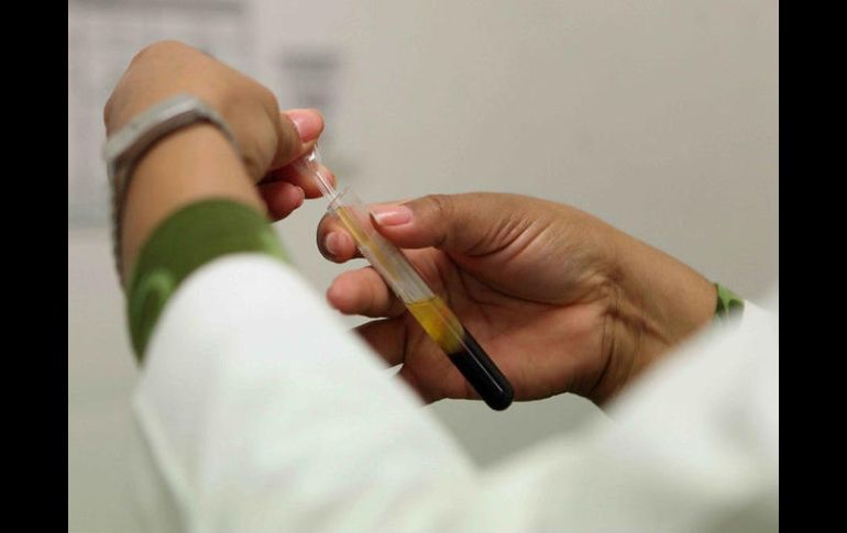 La toxina STEC provoca complicaciones renales e incluso causa la muerte. AP / ARCHIVO