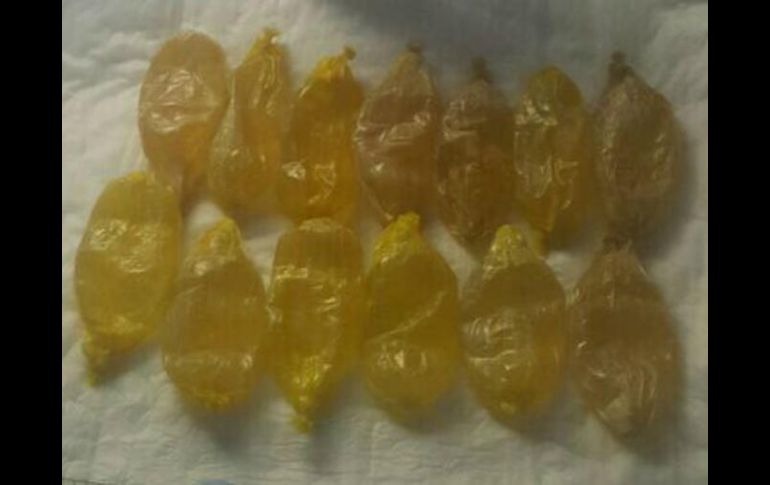 Tras detenerla, la mujer fue trasladada a un hospital donde arrojó las píldoras. ESPECIAL /