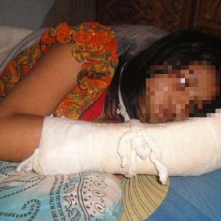 Hombre en Bangladesh corta dedos a esposa para evitar que estudie