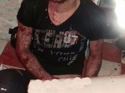 El señalado como allanador presentaba heridas más graves que el dueño del domicilio. ESPECIAL /