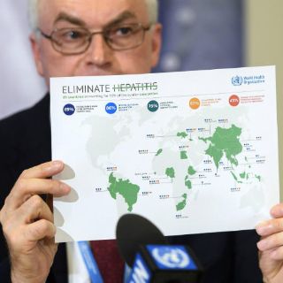 Cada año mueren 1.4 millones de personas por hepatitis