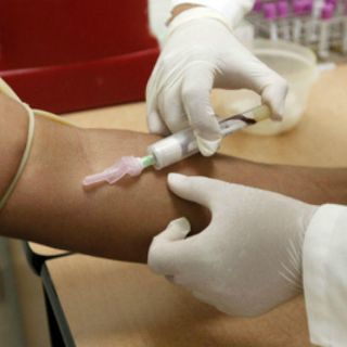 Hígado, principal órgano afectado por la hepatitis