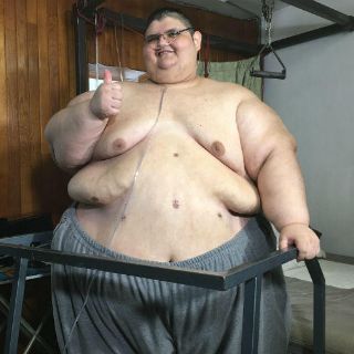 Hombre más obeso del mundo se levanta de la cama por primera vez