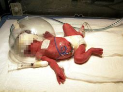 Según la Organización Mundial de la Salud (OMS), desde hace 20 años los nacimientos prematuros van en aumento. EL INFORMADOR / ARCHIVO