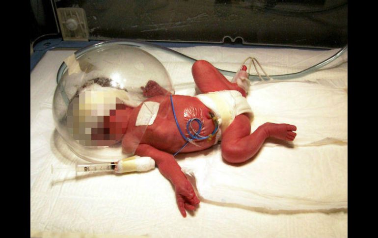 Según la Organización Mundial de la Salud (OMS), desde hace 20 años los nacimientos prematuros van en aumento. EL INFORMADOR / ARCHIVO