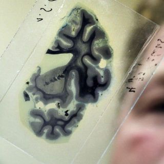 Expertos buscan abrir una 'ventana al cerebro'