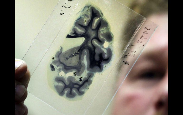 Los investigadores pretenden evitar la manipulación de cerebro y facilitar su inspección. EFE / ARCHIVO