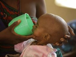 De los 800 mil niños malnutridos, 450 mil están en Nigeria, 247 mil 500 en Níger, 63 mik en Camerún y 22 mil en Chad. AP / ARCHIVO