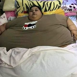 Muere la mujer más obesa del mundo mientras recibía tratamiento