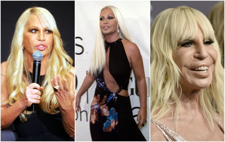 Con 62 años de edad, el paso del botox por el rostro de Donatella Versace se hace evidente. ESPECIAL