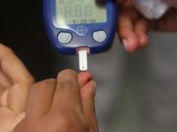 Destaca que el 12 por ciento de la población en México tiene diabetes mellitus, factor que incide en los problemas cardiacos. EL INFORMADOR/ ARCHIVO