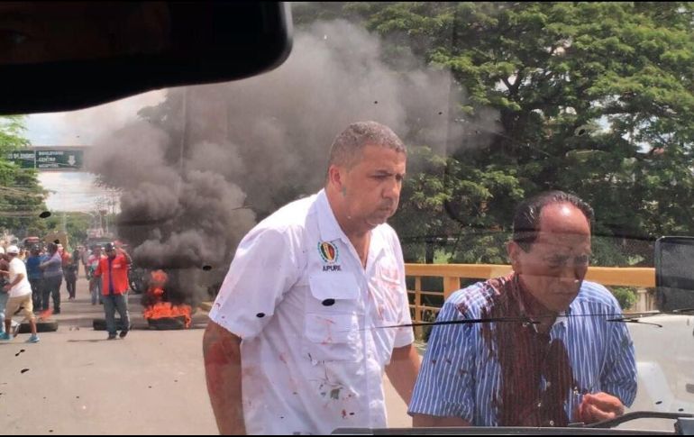 Henry Ramos compartió la imagen donde José Gregorio se ve con la playera manchada de sangre. TWITTER/@hramosallup