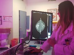 Sólo en Jalisco, en 2017 han fallecido 257 mujeres por cáncer de mama. ESPECIAL