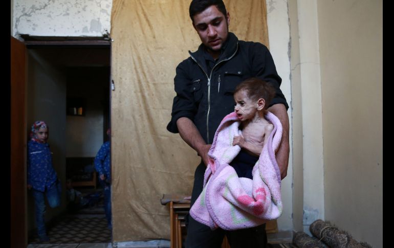 Un hombre sostiene a Hala, una niña de 2 años que padece por falta de atención médica y de nutrientes, en su casa en la ciudad siria de Saqba, bajo el control de rebeldes. La zona tiene problemas de acceso a alimentos y medicina. AFP/A. Eassa