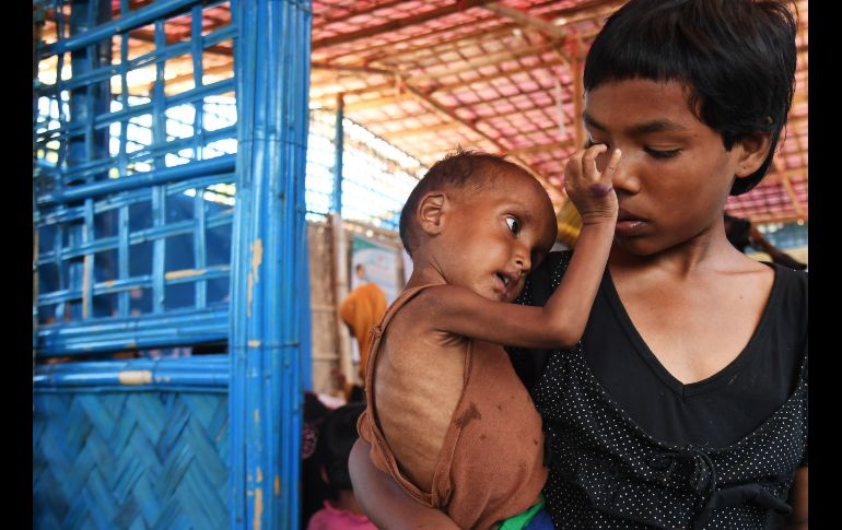 Zahid Hasan, refugiado rohinyá de un año, espera con su hermana para recibir tratamiento para desnutrición severa en el campamento Balukhali, Bangladesh. AFP/D. Sarkar