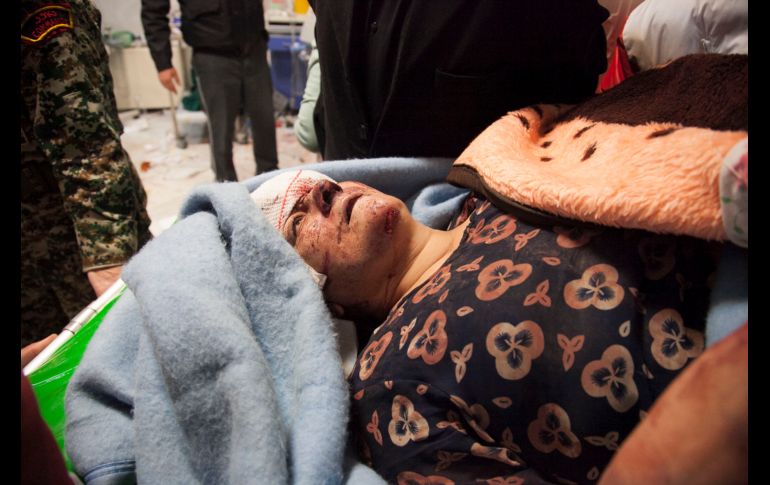 Una mujer lesionada recibe atención en un hospital iraní. Se reportan al menos seis mil 700 heridos en el país.