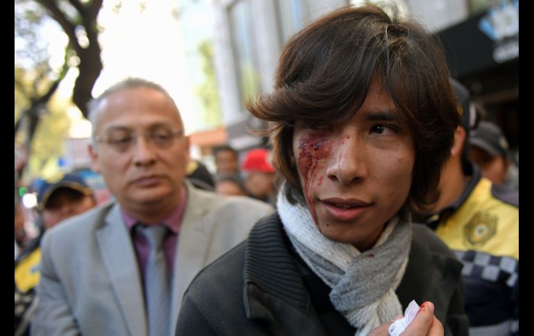 Un joven muestra una herida que le ocasionó un hombre mientras se manifestaba.