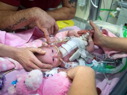 El hospital considera que Vanellope afronta aún un largo camino por delante, en el que el riesgo principal son las posibles infecciones. AP / B. Birchall