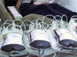 Fibrosis Quística, Hemofilia, Histiocitosis, Espina Bífida, Gaucher tipos I, II y III, entre otras, son enfermedades consideradas raras. AP / ARCHIVO