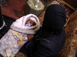 Karim perdió el ojo en un bombardeo el 29 de octubre, cuando solo tenía 40 días de nacido. EFE / M. Badra