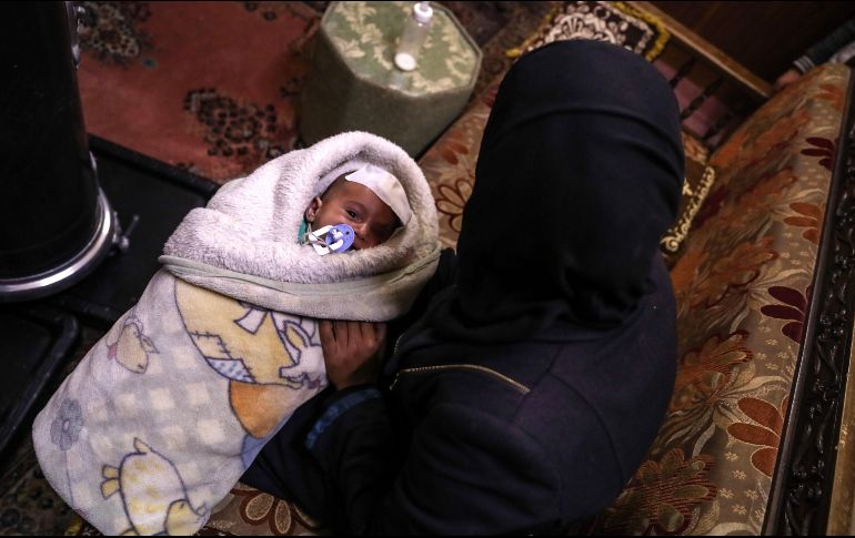 Karim perdió el ojo en un bombardeo el 29 de octubre, cuando solo tenía 40 días de nacido. EFE / M. Badra