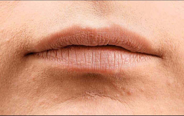La región labial es de las zonas más sensibles del cuerpo que muestran los efectos de la resequedad; el hábito de morder o lamer constantemente los labios para lubricarlos aumenta la resequedad. SUN / ARCHIVO