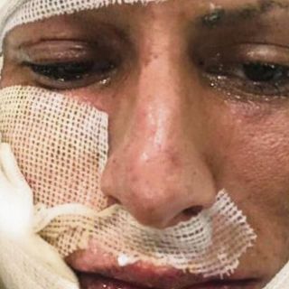 Se lastimaron... ¡Aunque usted no lo crea!