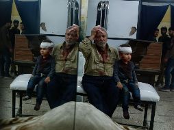 Un hombre y un niño reciben atención médica tras resultar heridos en uno de los ataques. AFP/H. Mohamed