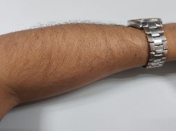 El escalofrío se manifiesta como una especie de hormigueo que recorre el cuerpo, pone la 