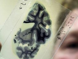 En caso de que la zona cerebral donde se alberga esta función resulte dañada, la persona puede perder la capacidad de distinguir la realidad, el pasado y el presente, sin darse cuenta. EFE / ARCHIVO