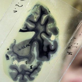 El cerebro, encargado de separar la realidad de la imaginación