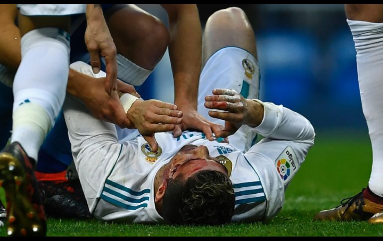 Cristiano Ronaldo quedó en el suelo tras recibir el golpe. AFP/O. Del Pozo