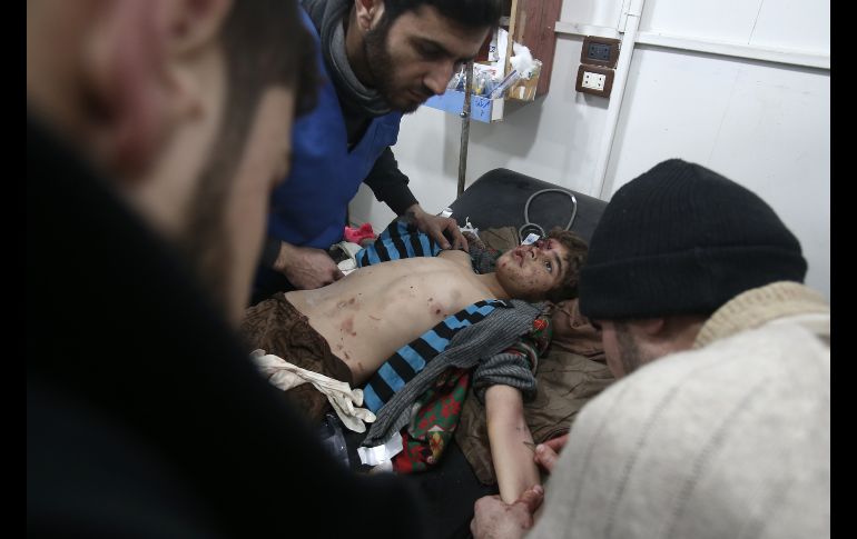 Un niño recibe tratamiento en un hospital hechizo en la población siria de Arbin, bajo control de los rebeldes, luego de bombardeos aéreos en la zona. AFP/A. Eazza