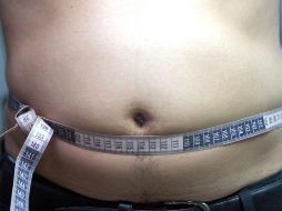 Consideran que un paciente oncológico que tiene sobrepeso y obesidad tiene un pronóstico más malo para combatir algún cáncer. EL INFORMADOR / ARCHIVO