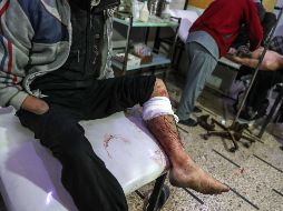 El conflicto en la zona ha dejado cientos de heridos. EFE/M. Badra