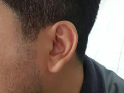 Hay dos causas comunes del vértigo: un virus llamado laberintis, una infección en el oído interno y un problema en los oídos donde los cristales de calcio dentro del oído interno se desplazan. EL INFORMADOR