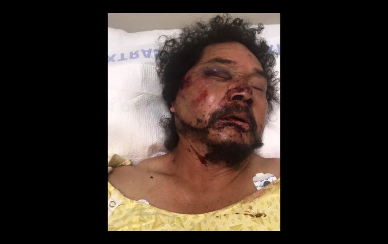 Se inició una colecta en la página GoFundMe para pagar sus gastos médicos.  ESPECIAL / www.gofundme.com