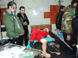 Fotografía cedida por SANA donde se observa a un niño herido que es tratado en un hospital del gobierno en la ciudad de Jaramana, a las afueras de Damasco. EFE/SANA