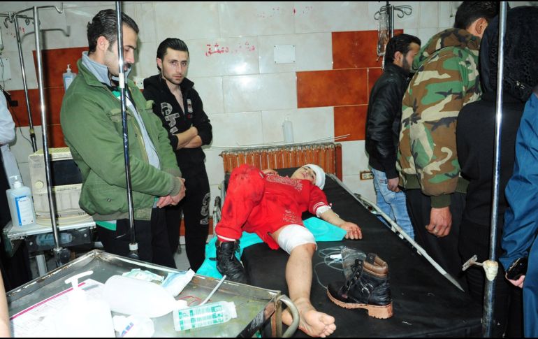 Fotografía cedida por SANA donde se observa a un niño herido que es tratado en un hospital del gobierno en la ciudad de Jaramana, a las afueras de Damasco. EFE/SANA