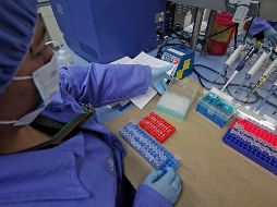 De haberse detectado a tiempo, podría haber aumentado hasta el 90 % sus posibilidades de curación y supervivencia. SUN/ARCHIVO