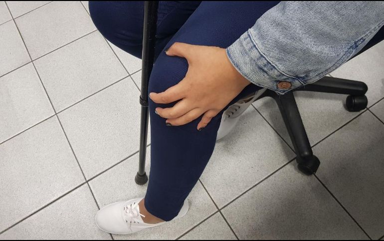 Un nuevo estudio reveló que la prevalencia de la osteoartritis en las rodillas de los seres humanos se duplicó desde mediados del siglo XX. EL INFORMADOR